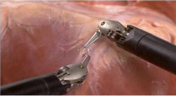 醫療手術（shù）機器（qì）人膠水